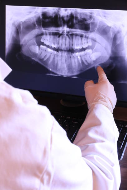 Best Emergency Tooth Extraction in Lewistown, PA